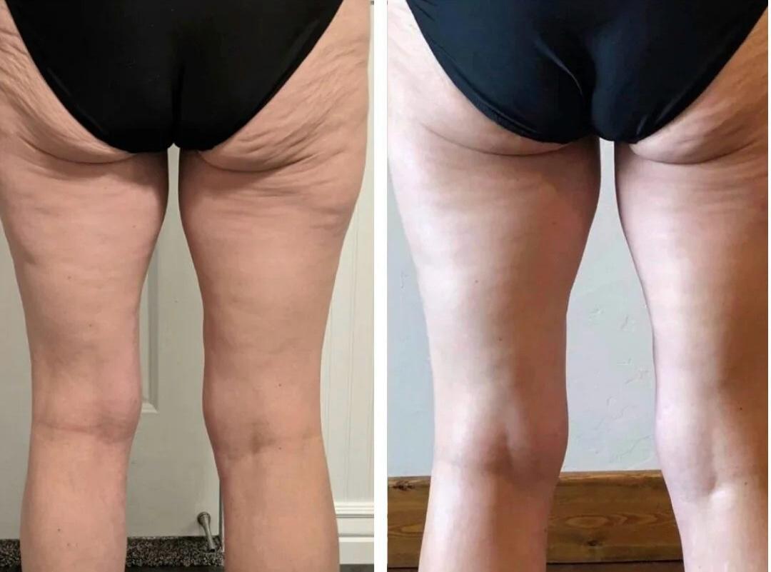 <em>Ava R. – New York, NY</em>