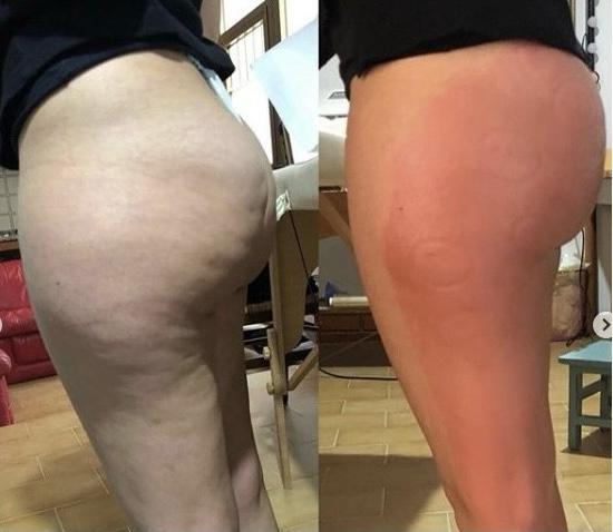 <em>Emily S. – Los Angeles, CA</em>